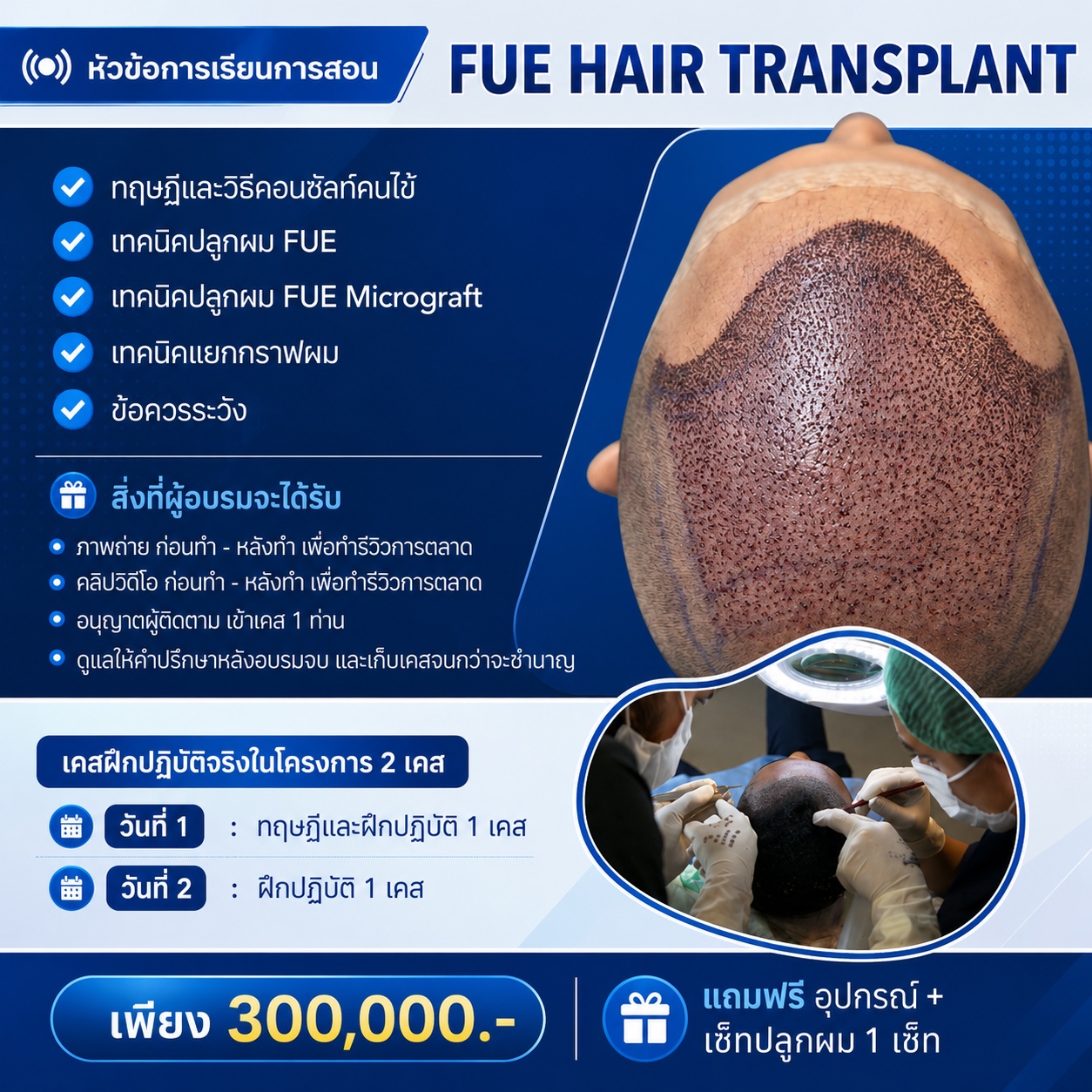 FUE Hair Transplant