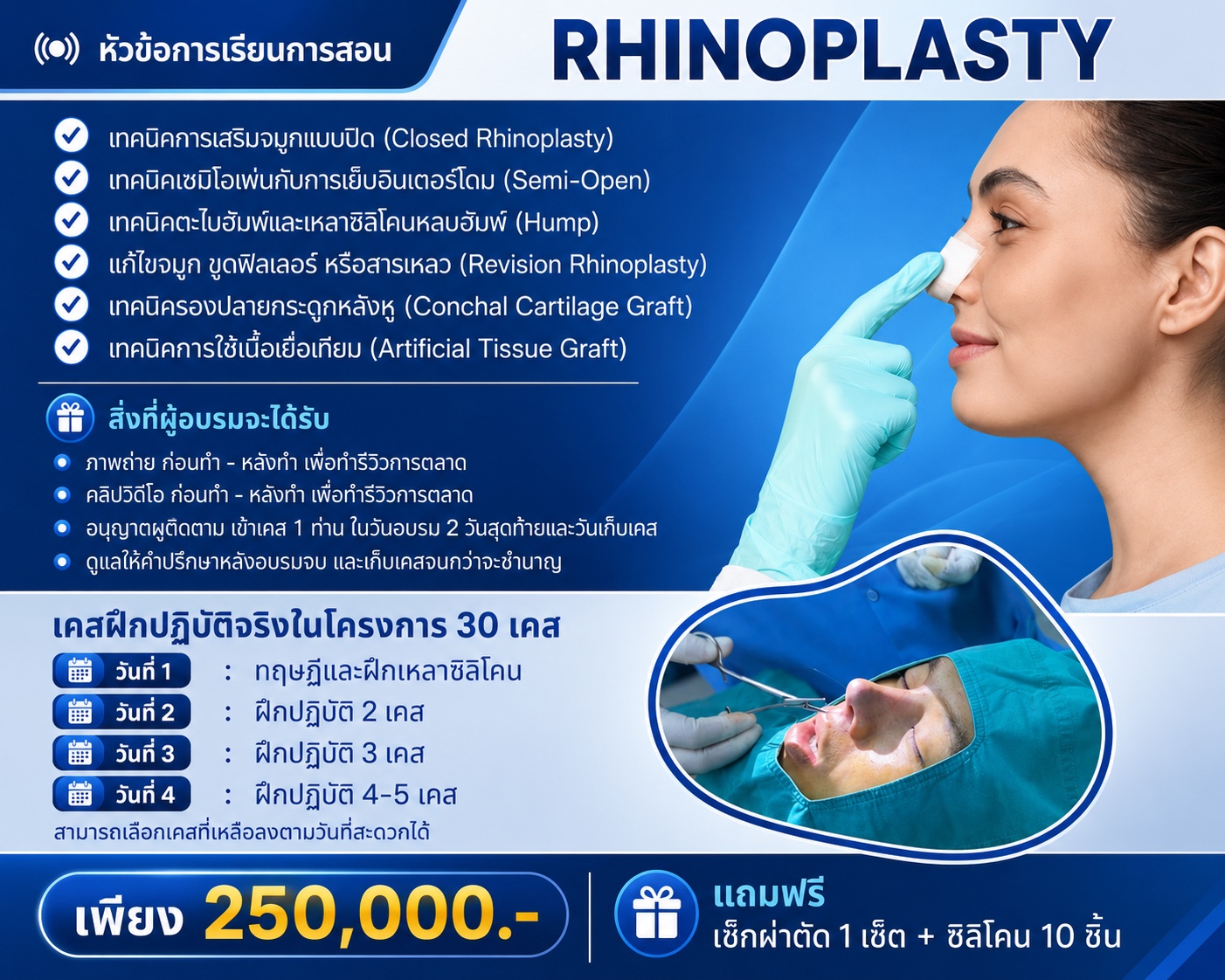 Rhinoplasty